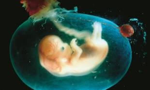bambini piu sani dagli embrioni congelati h partb
