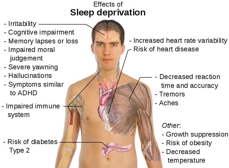 effetti della privazione del sonno insonnia