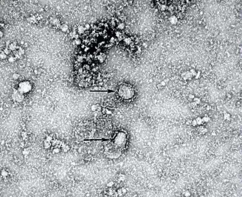 coronavirus al microscopio 1