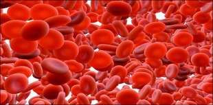 anemia 1