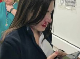 anna procida - infermiera picchiata in un pronto soccorso di catellamare 1
