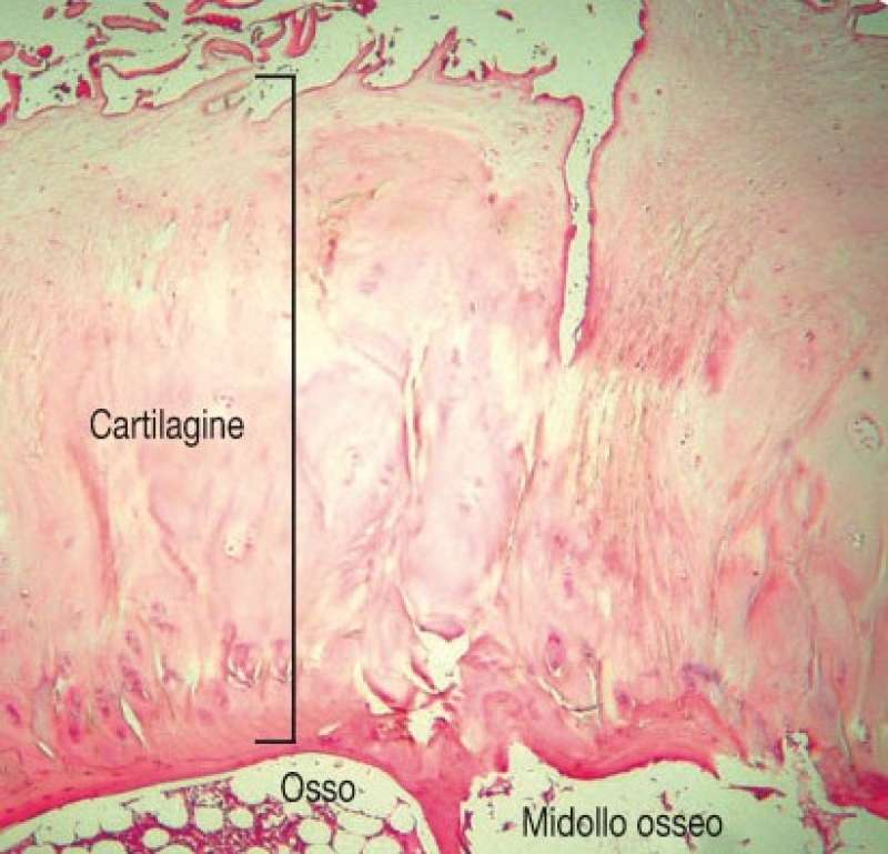 cartilagine 5