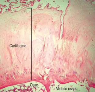 cartilagine 5