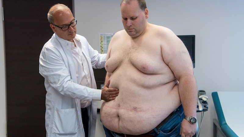 obesi in pericolo per il virus