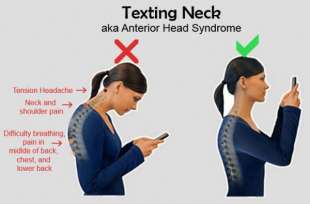 sindrome del collo da smartphone 1
