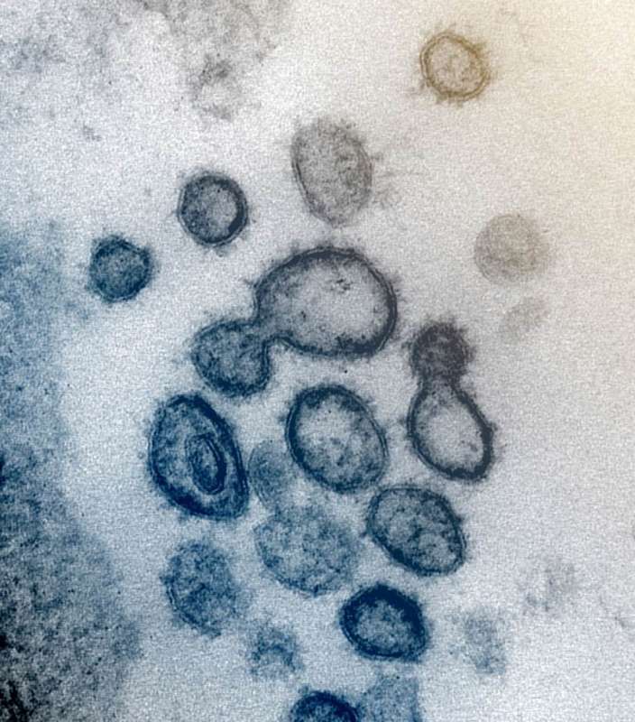 coronavirus al microscopio 1
