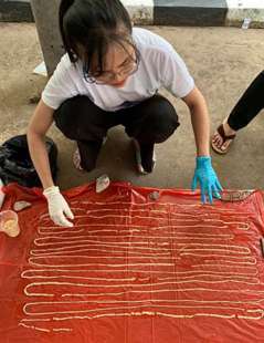 verme solitario di 18 metri nella pancia di un uomo in thailandia 7