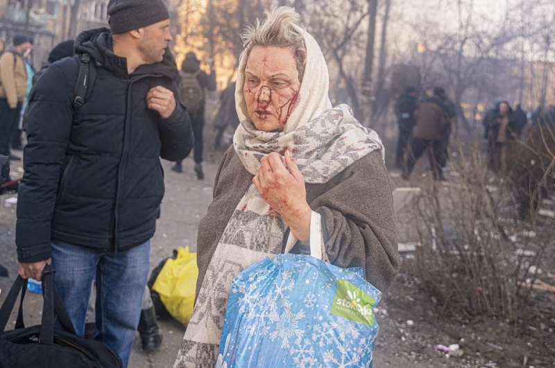 donna ferita a kiev