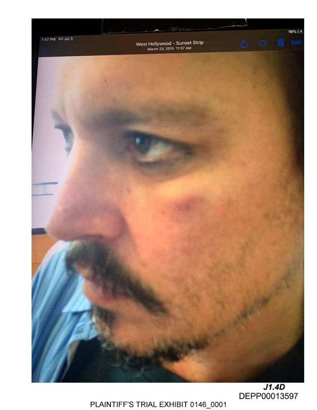 Le foto di Johnny Depp ferito nel 2015