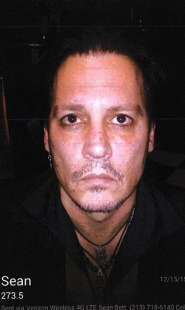 Le foto di Johnny Depp ferito nel 2015 3
