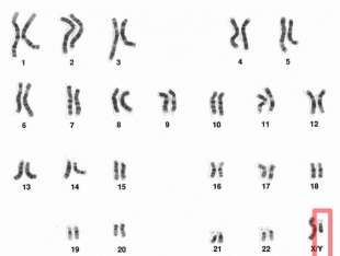 cromosoma y