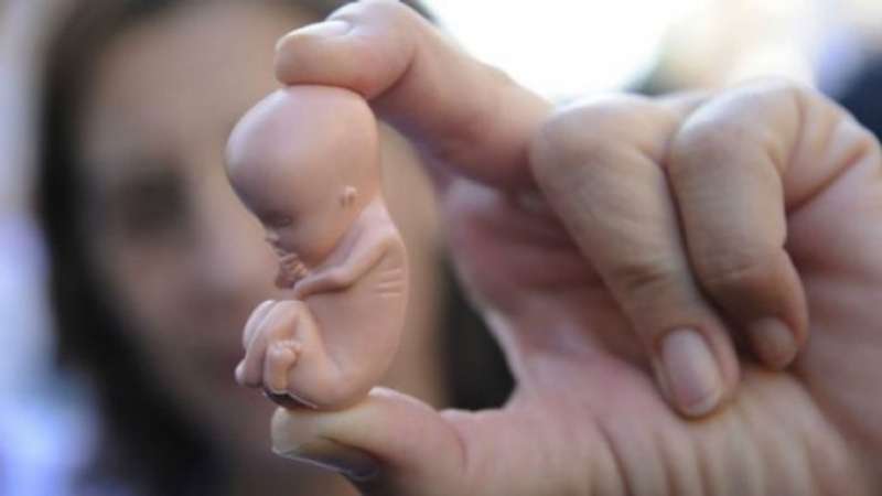 feto di plastica
