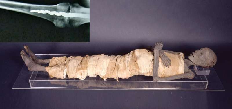 Mummia incinta