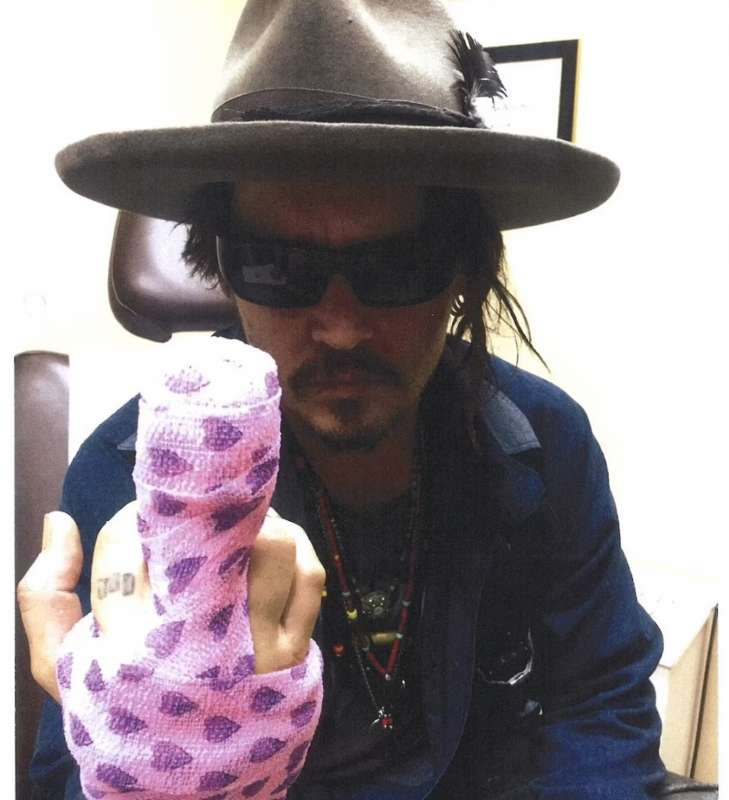 Il dito fasciato di Johnny Depp