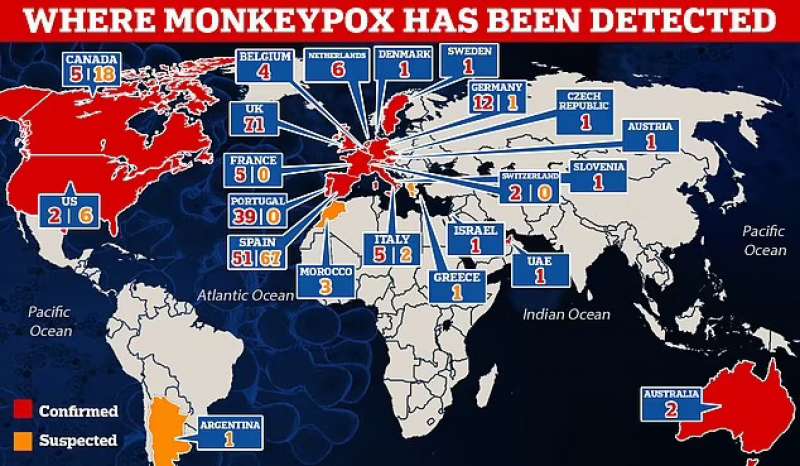 Vaiolo delle scimmie nel mondo 25 maggio 2022