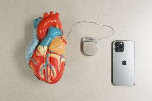 IPHONE PACEMAKER 2