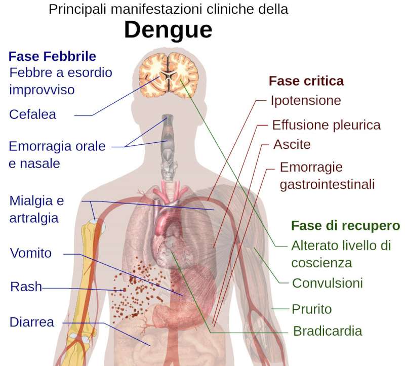 Sintomi Dengue