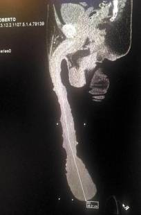 la radiografia del pene di roberto esquivel cabrera