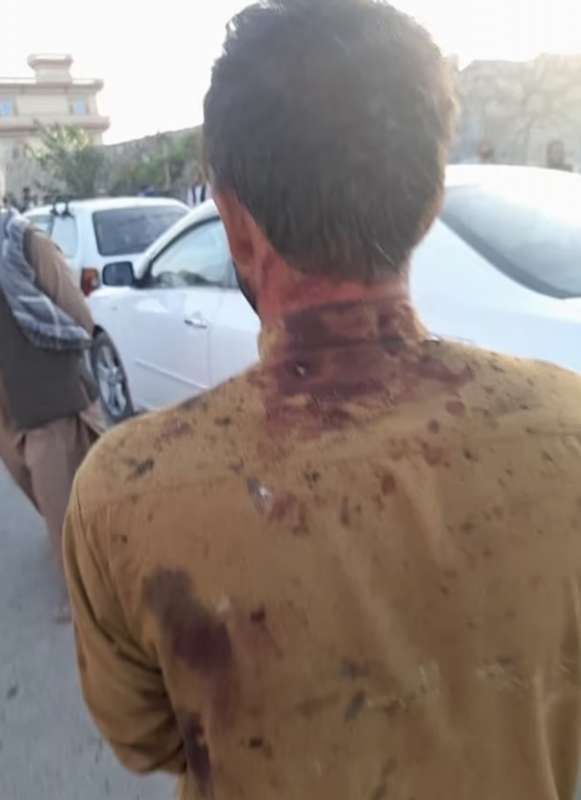 attentato all aeroporto di kabul 13