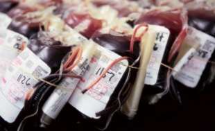 trasfusione di sangue 6