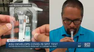 test salivare coronavirus