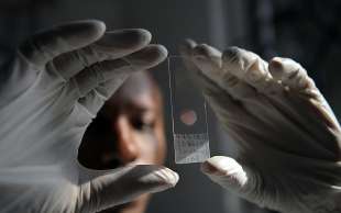 vaccino contro la malaria 1