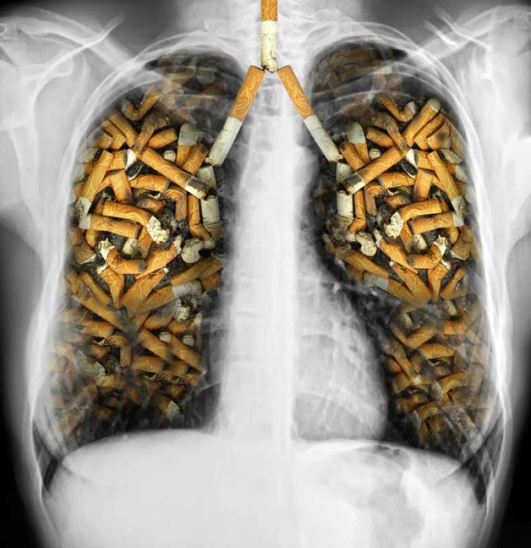 polmoni e sigarette