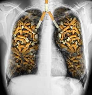 polmoni e sigarette