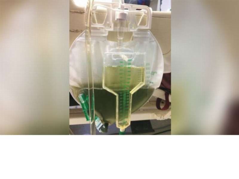 urina verde