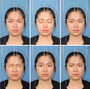 facial surface electromyography 3