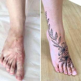 tatuaggi per coprire cicatrici